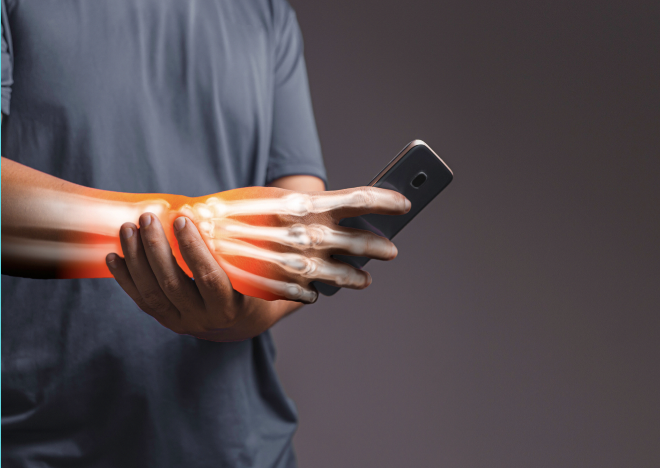 Carpal Tunnel Syndrome (CTS)